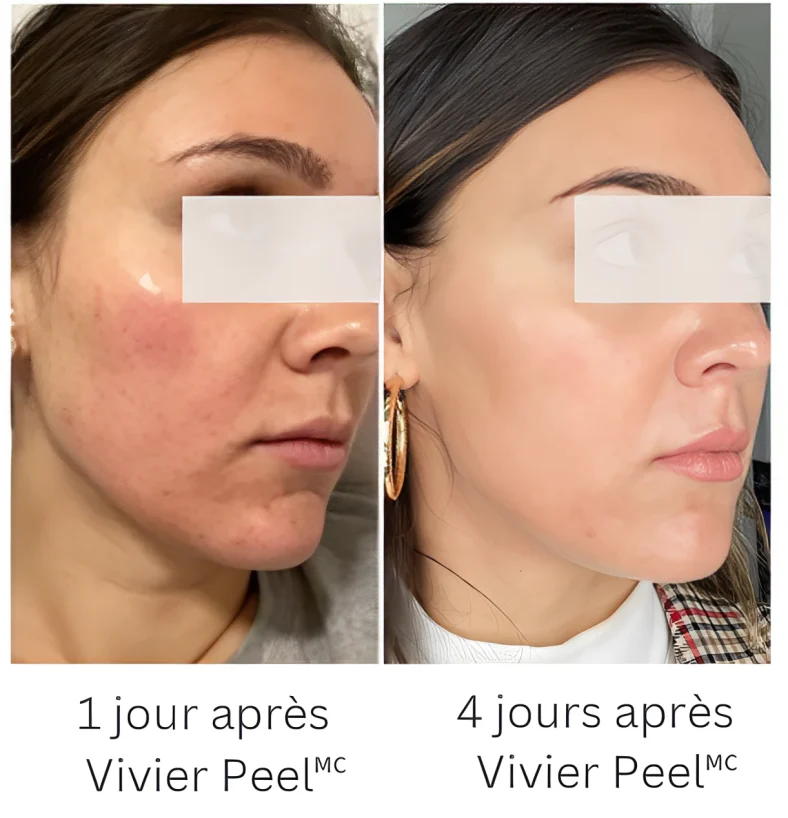 Avant-apres-2