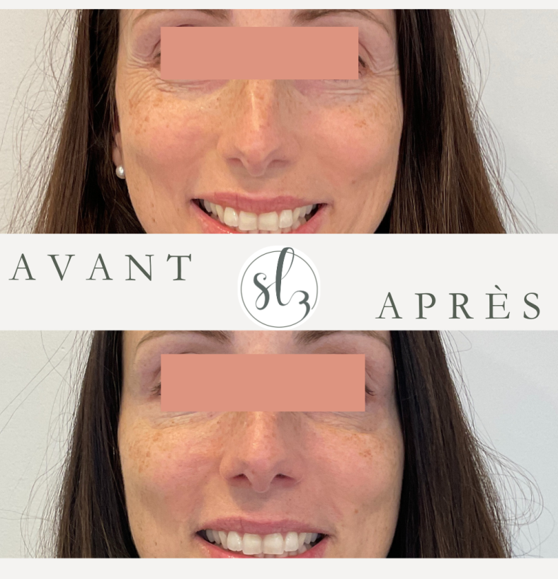 PageNeuromod_AvantAprès
