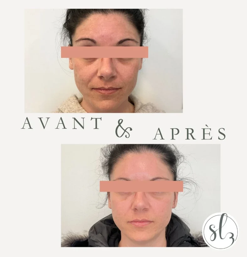 PagePromo_AvantAprès1