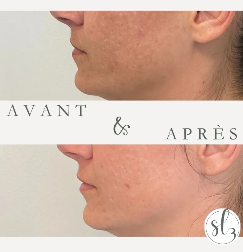 PagePromo_AvantAprès2