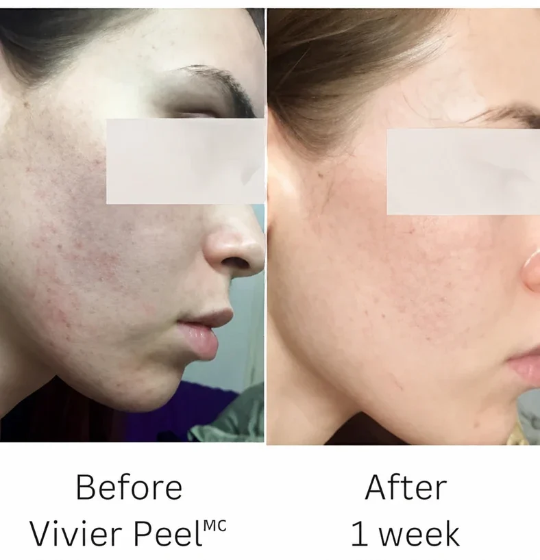 img-after-before-facial-care
