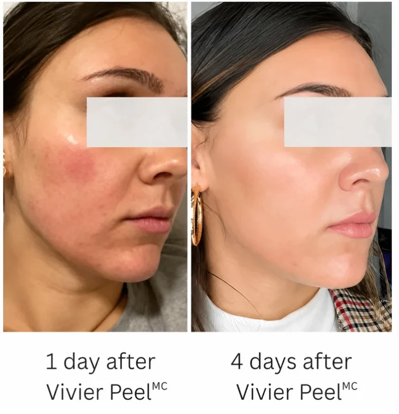 img-after-before-medical-cosmetic